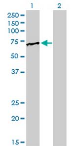 FUBP1 Antibody in Western Blot (WB)