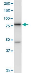 DDX18 Polyclonal Antibody, MaxPab™