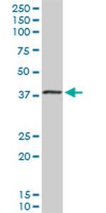 EIF2B2 Antibody in Western Blot (WB)