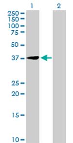 EIF2B2 Antibody in Western Blot (WB)