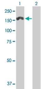 MTMR3 Antibody in Western Blot (WB)