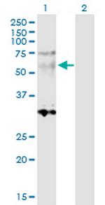 SGCE Polyclonal Antibody, MaxPab™