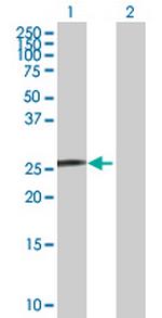 SNURF Antibody in Western Blot (WB)
