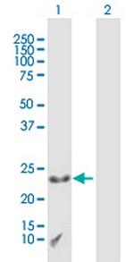 CXX1 Antibody in Western Blot (WB)