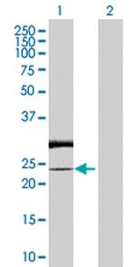 RAB7L1 Polyclonal Antibody, MaxPab™