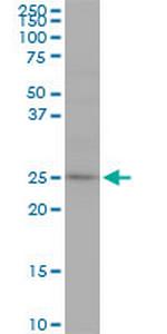 RAB7L1 Monoclonal Antibody (1B10)