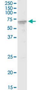 FUBP3 Monoclonal Antibody (7B10)