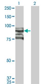 TOP3B Monoclonal Antibody (1H8)