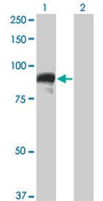 TOP3B Monoclonal Antibody (4H7)