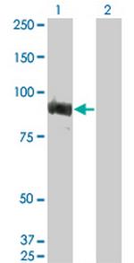TOP3B Monoclonal Antibody (2G2)