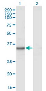 KYNU Monoclonal Antibody (1G2)