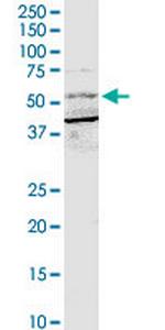 BTRC Polyclonal Antibody, MaxPab™