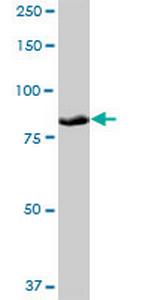 PLOD3 Polyclonal Antibody, MaxPab™
