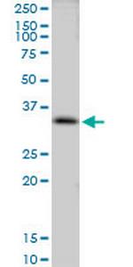 CLIC3 Polyclonal Antibody, MaxPab™