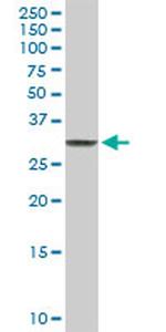 CLIC3 Antibody in Western Blot (WB)