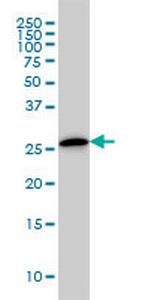 CLIC3 Monoclonal Antibody (3F8)