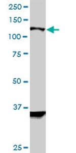 HIP1R Antibody in Western Blot (WB)