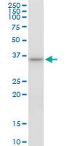 AIP Monoclonal Antibody (3D3)