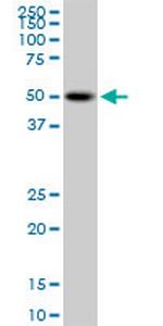 PSTPIP1 Monoclonal Antibody (1D5)