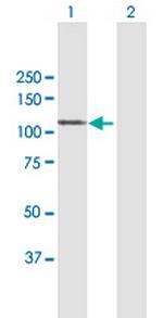 MAP7 Antibody in Western Blot (WB)