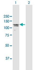 MAP7 Antibody in Western Blot (WB)