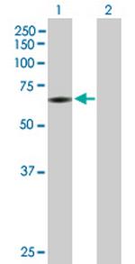 PAPSS2 Polyclonal Antibody, MaxPab™