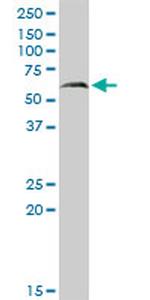 PAPSS2 Antibody in Western Blot (WB)