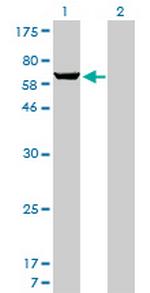 PAPSS1 Monoclonal Antibody (1F4)
