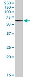 ASH2L Antibody in Western Blot (WB)