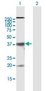 CLDN10 Polyclonal Antibody, MaxPab™