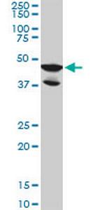 LDB2 Monoclonal Antibody (1A3)