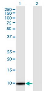 TMSB4Y Antibody in Western Blot (WB)