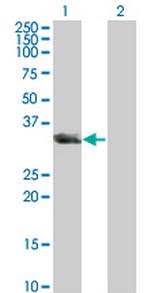 UNC119 Monoclonal Antibody (2F9-2A9)