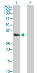 UNC119 Antibody in Western Blot (WB)