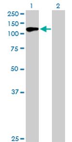 USP10 Antibody in Western Blot (WB)