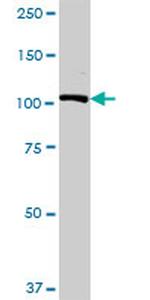USP10 Antibody in Western Blot (WB)