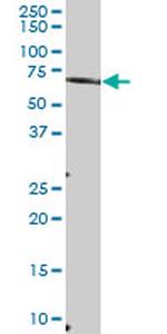 MTMR6 Antibody in Western Blot (WB)