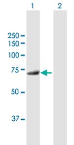MTMR6 Polyclonal Antibody, MaxPab™