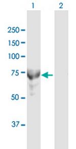 MTMR6 Polyclonal Antibody, MaxPab™