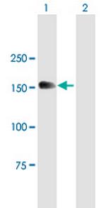 MTMR4 Antibody in Western Blot (WB)