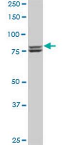 MTA1 Monoclonal Antibody (4D11)
