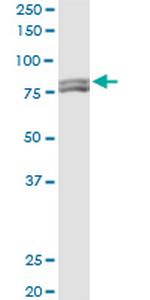 MTA1 Monoclonal Antibody (2D4)