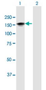 LATS1 Polyclonal Antibody, MaxPab™