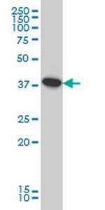 ATP6V0D1 Monoclonal Antibody (2G12)