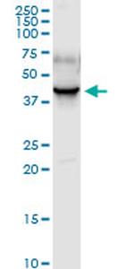 PDLIM1 Antibody in Western Blot (WB)