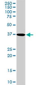 PDLIM1 Antibody in Western Blot (WB)
