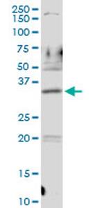 PDLIM1 Antibody in Western Blot (WB)
