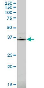 PDLIM1 Monoclonal Antibody (2D4)