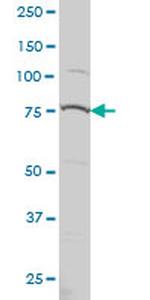 PRPF3 Antibody in Western Blot (WB)
