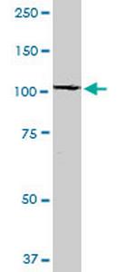 RABEP1 Antibody in Western Blot (WB)